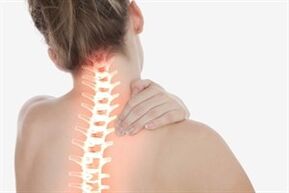 Ostéochondrose cervicale chez une femme